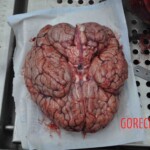 Autopsy of young woman