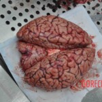 Autopsy of young woman