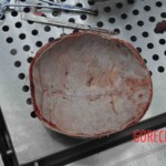 Autopsy of young woman