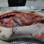 Autopsy of young woman