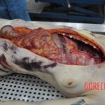 Autopsy of young woman