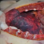 Autopsy of young woman