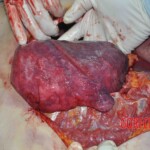 Autopsy of young woman