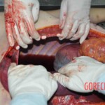 Autopsy of young woman