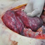 Autopsy of young woman