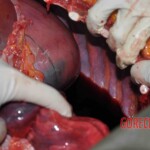 Autopsy of young woman