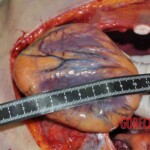 Autopsy of young woman