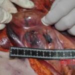 Autopsy of young woman