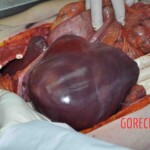 Autopsy of young woman