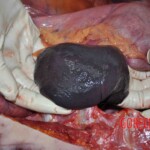 Autopsy of young woman