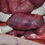 Autopsy of young woman