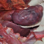 Autopsy of young woman