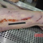 Autopsy of young woman