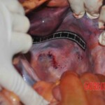 Autopsy of young woman