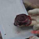 Autopsy of young woman