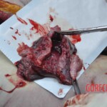 Autopsy of young woman