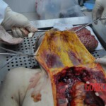 Autopsy of young woman