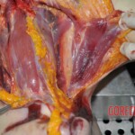 Autopsy of young woman