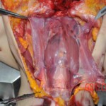 Autopsy of young woman