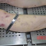 Autopsy of young woman