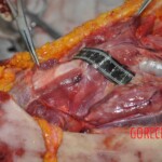 Autopsy of young woman