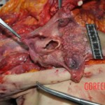 Autopsy of young woman