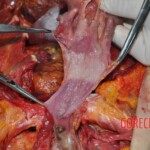 Autopsy of young woman