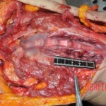 Autopsy of young woman