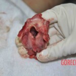 Autopsy of young woman