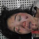 Autopsy of young woman