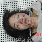 Autopsy of young woman