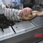 Autopsy of young woman