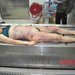 Autopsy of young woman