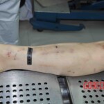 Autopsy of young woman