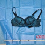 Autopsy of young woman