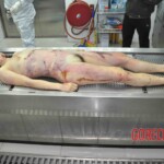Autopsy of young woman