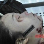 Autopsy of young woman