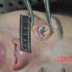 Autopsy of young woman