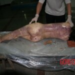 Autopsy of woman