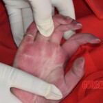 Dead woman in red dress