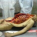 Dead female autopsy