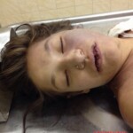 Naked girl on morgue table