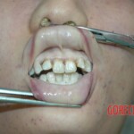 Raped Chinese female