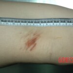 Raped Chinese female