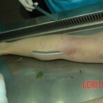 Raped Chinese female