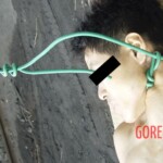 Sodomized hanged man