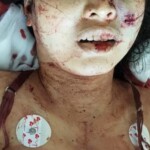 Shot dead by her fiance