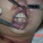 Murdered by ex-boyfriend