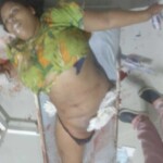 Woman Lost Her Entire Leg in Traffic Accident