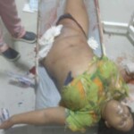 Woman Lost Her Entire Leg in Traffic Accident